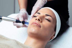 microneedling and mesotherapy Denver