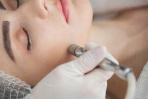 Diamond microdermabrasion peeling cosmetic woman during a microdermabrasion treatment in beauty salon › Hellenic Laser Spa Woman undergoing a microdermabrasion session at a skincare clinic, with a professional using a specialized device to exfoliate her facial skin.
