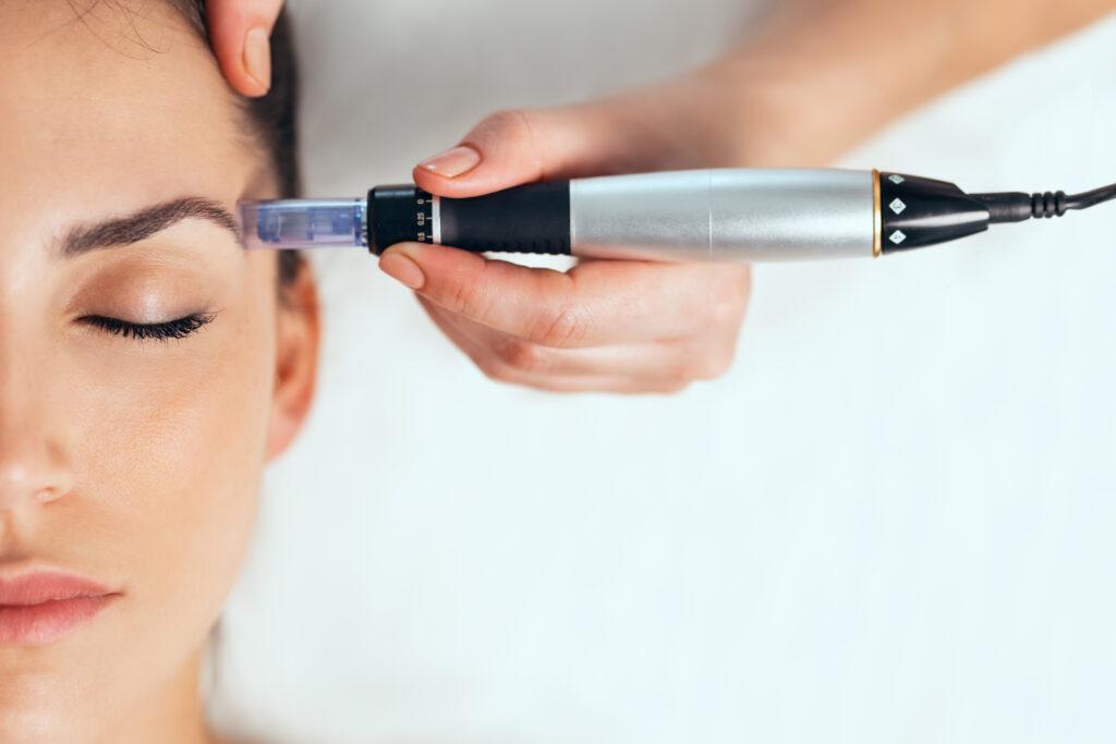A woman undergoing microneedling as part of a body skin care treatment to improve skin tone, texture, and overall firmness.