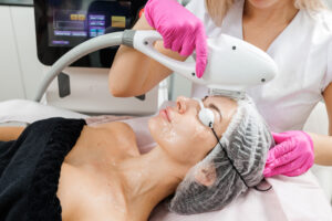 Woman undergoing a Photofacial treatment, with a specialist applying the procedure to improve skin tone and texture.